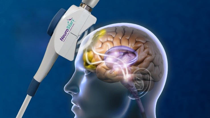 TMS Therapy